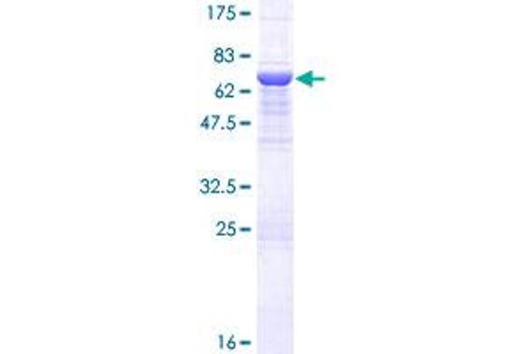 HPS3 Protein (AA 1-372) (GST tag)