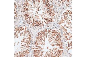Immunohistochemistry of paraffin-embedded Mouse testis using KIF2C/MCAK antibody (ABIN6128155, ABIN6142869, ABIN6142870 and ABIN6221103) at dilution of 1:100 (40x lens).