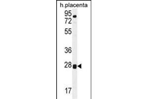 TOR2A Antibody (Center) (ABIN656112 and ABIN2850491) western blot analysis in human placenta tissue lysates (35 μg/lane). (TOR2A Antikörper  (AA 194-221))