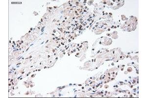 Image no. 1 for anti-Glial Fibrillary Acidic Protein (GFAP) antibody (ABIN1498436) (GFAP Antikörper)