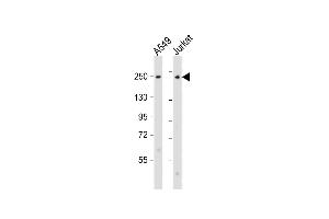 All lanes : Anti-COL11A1 Antibody (N-Term) at 1:2000 dilution Lane 1: A549 whole cell lysate Lane 2: Jurkat whole cell lysate Lysates/proteins at 20 μg per lane. (COL11A1 Antikörper  (AA 41-75))