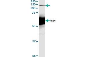 Immunoprecipitation of MCM2 transfected lysate using anti-MCM2 MaxPab rabbit polyclonal antibody and Protein A Magnetic Bead , and immunoblotted with MCM2 MaxPab rabbit polyclonal antibody (D01) . (MCM2 Antikörper  (AA 1-904))