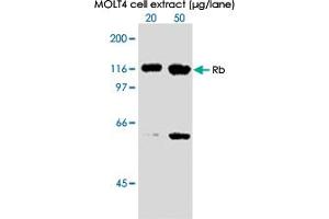 Western blot analysis in extracts from MOLT 4 cell using RB1 (phospho S612) monoclonal antibody, clone 3C11 . (Retinoblastoma 1 Antikörper  (pSer612))