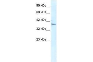 Western Blot showing KLHL14 antibody used at a concentration of 1-2 ug/ml to detect its target protein.