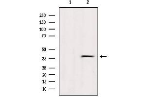 Western blot analysis of extracts from Hela, using OR5R1 Antibody. (OR5R1 Antikörper  (Internal Region))