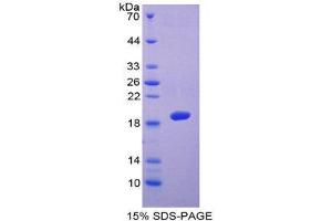 SDS-PAGE (SDS) image for ADAM Metallopeptidase with thrombospondin Type 1 Motif, 5 (ADAMTS5) (AA 485-622) protein (His tag) (ABIN2123881)