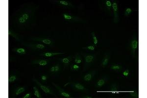 Immunofluorescence of monoclonal antibody to HDAC3 on HeLa cell.