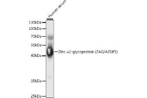 Western blot analysis of extracts of human serum, using Zinc-α2-glycoprotein (ZAG/Zinc-α2-glycoprotein (ZAG/)) antibody (ABIN6131435, ABIN6137386, ABIN6137387 and ABIN6221006) at 1:1000 dilution. (AZGP1 Antikörper  (AA 21-298))