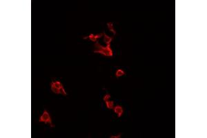 ABIN6266708 staining HeLa cells by IF/ICC.