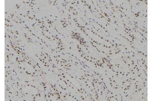 ABIN6277620 at 1/100 staining Human kidney tissue by IHC-P. (UBE2C Antikörper  (C-Term))