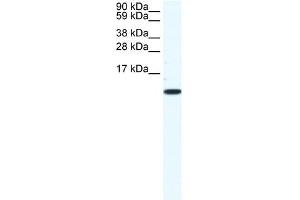 CCL5 antibody (20R-1137) used at 1. (CCL5 Antikörper  (Middle Region))