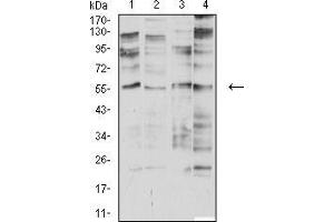 CHRNA2 Antikörper  (AA 27-264)