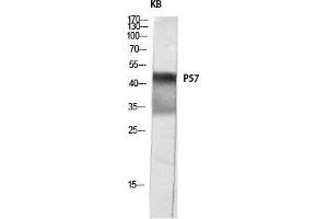 Western Blot (WB) analysis of KB lysis using p57 antibody. (P57 (Ser238) Antikörper)
