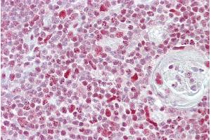 Immunohistochemistry (IHC) image for anti-Nuclear Factor of Activated T-Cells, Cytoplasmic, Calcineurin-Dependent 3 (NFATC3) (N-Term) antibody (ABIN2792685)