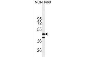 Western Blotting (WB) image for anti-Fibrinogen-Like 2 (FGL2) antibody (ABIN2996032)