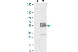Western blot analysis of Lane 1: Negative control (vector only transfected HEK293T lysate). (MFSD8 Antikörper)