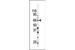Image no. 1 for anti-SMAD, Mothers Against DPP Homolog 3 (SMAD3) (pSer213) antibody (ABIN358226) (SMAD3 Antikörper  (pSer213))
