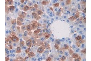 Detection of CAPN1 in Mouse Liver Tissue using Polyclonal Antibody to Calpain 1 (CAPN1)