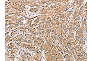 Immunohistochemistry (IHC) image for anti-Wingless-Type MMTV Integration Site Family, Member 11 (WNT11) antibody (ABIN7131608)