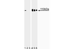Western blot analysis of Rb (pS780) in human embryonic skin cells. (Retinoblastoma 1 Antikörper  (pSer780))