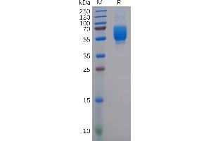 Human CD62L Protein, His Tag on SDS-PAGE under reducing condition.