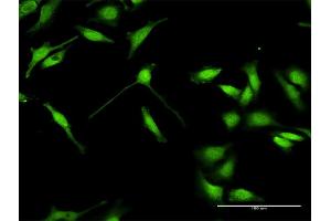 Immunofluorescence of purified MaxPab antibody to ELAVL4 on HeLa cell. (ELAVL4 Antikörper  (AA 1-366))