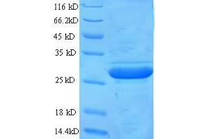 SDS-PAGE (SDS) image for Glypican 4 (GPC4) (AA 530-557) protein (GST tag) (ABIN5713476)