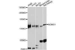 Western blot analysis of extracts of various cell lines, using NOMO1 antibody (ABIN5998361) at 1:7000 dilution. (NOMO1 Antikörper)