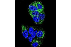 Confocal immunofluorescent analysis of HNF4A Antibody (N-term) (ABIN653385 and ABIN2842849) with MCF-7 cell followed by Alexa Fluor 488-conjugated goat anti-rabbit lgG (green). (HNF4A Antikörper  (N-Term))