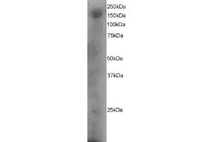 ABIN184630 staining (4µg/ml) of A431 lysate (RIPA buffer, 35µg total protein per lane). (DOCK1 Antikörper  (C-Term))