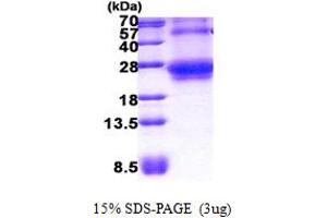 RHOQ Protein (AA 1-202) (His tag)