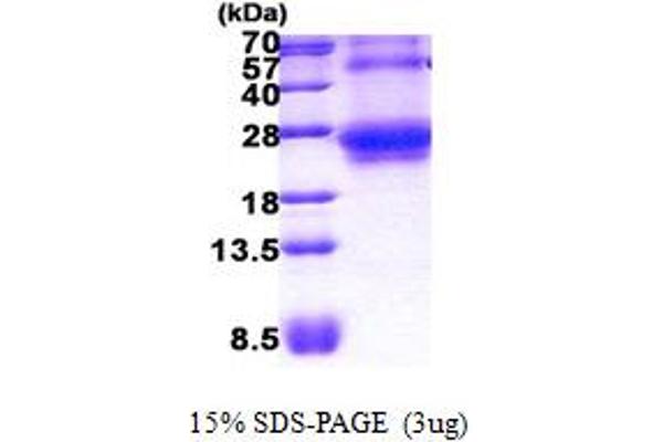 RHOQ Protein (AA 1-202) (His tag)