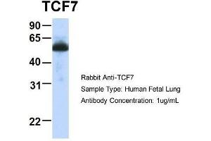 Host:  Rabbit  Target Name:  TCF7  Sample Type:  Human Fetal Lung  Antibody Dilution:  1. (TCF7 Antikörper  (Middle Region))