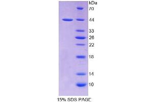 SDS-PAGE analysis of Rat PTHR2 Protein. (PTH2R Protein)