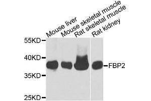 Western blot analysis of extracts of various cell lines, using FBP2 antibody. (FBP2 Antikörper  (AA 1-339))