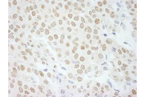 Immunohistochemistry (IHC) image for anti-Pleiotropic Regulator 1 (PLRG1) (AA 464-514) antibody (ABIN7449000) (PLRG1 Antikörper  (AA 464-514))
