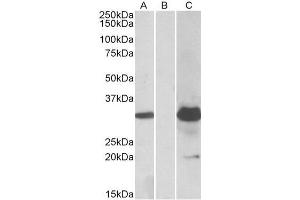 HEK293 lysate (10ug protein in RIPA buffer) overexpressing Human KCTD11 with DYKDDDDK tag probed with ABIN625814 (1. (KCTD11 Antikörper  (Internal Region))