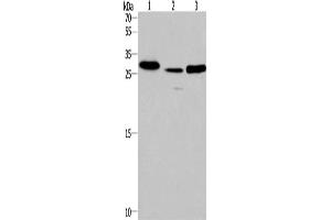 Western Blotting (WB) image for anti-Interleukin-1 Receptor-Associated Kinase 1 Binding Protein 1 (IRAK1BP1) antibody (ABIN5543583) (IRAK1BP1 Antikörper)