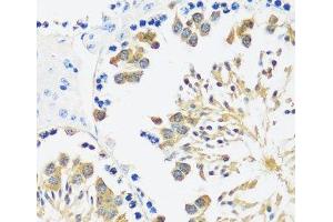 Immunohistochemistry of paraffin-embedded Mouse testis using CALM3 Polyclonal Antibody at dilution of 1:100 (40x lens). (Calmodulin 3 Antikörper)