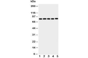 Western blot testing of Ku80 antibody and Lane 1:  Jurkat;  2: CEM;  3: Raji;  4: COLO320;  5: HT1080 cell lysate