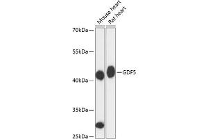 Western blot analysis of extracts of various cell lines, using GDF5 antibody (ABIN6133596, ABIN6141044, ABIN6141045 and ABIN6217062) at 1:3000 dilution. (GDF5 Antikörper  (AA 350-450))