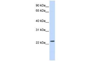 WB Suggested Anti-SCAND2 Antibody Titration: 0. (SCAND2 Antikörper  (Middle Region))