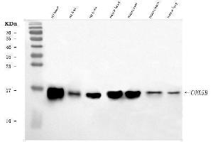 Western blot analysis of COX5B using anti-COX5B antibody (ABIN7598975). (COX5B Antikörper  (AA 1-129))
