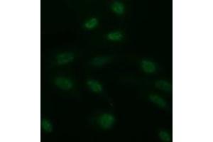 Image no. 4 for anti-CD163 (CD163) antibody (ABIN1497176)