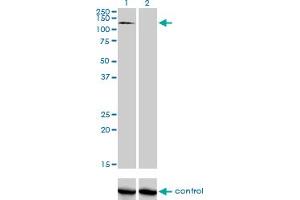 Western blot analysis of RNF111 over-expressed 293 cell line, cotransfected with RNF111 Validated Chimera RNAi (Lane 2) or non-transfected control (Lane 1). (RNF111 Antikörper  (AA 1-108))