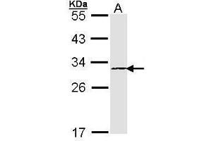 WB Image Sample (30 ug of whole cell lysate) A: A431 , 12% SDS PAGE antibody diluted at 1:1000 (PSMB4 Antikörper)