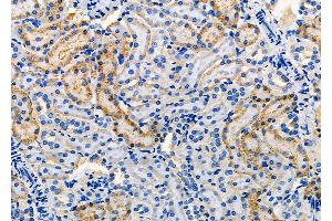 ABIN6260802 and ABIN6277859 at 1/100 staining Rat kidney tissue by IHC-P. (Chromogranin A Antikörper  (C-Term))