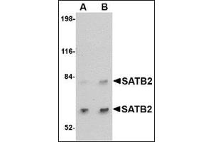 Western blot analysis of SATB2 in A20 cell lysate with this product at (A) 2 and (B) 4 μg/ml. (SATB2 Antikörper  (C-Term))