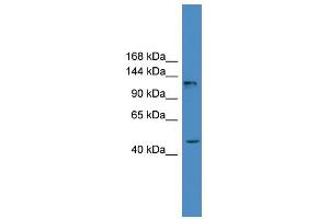 WB Suggested Anti-ADCY2 Antibody Titration:  0. (ADCY2 Antikörper  (Middle Region))