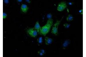 Anti-MGRN1 mouse monoclonal antibody (ABIN2454418) immunofluorescent staining of COS7 cells transiently transfected by pCMV6-ENTRY MGRN1 (RC208284). (Mahogunin RING Finger Protein 1 Antikörper)